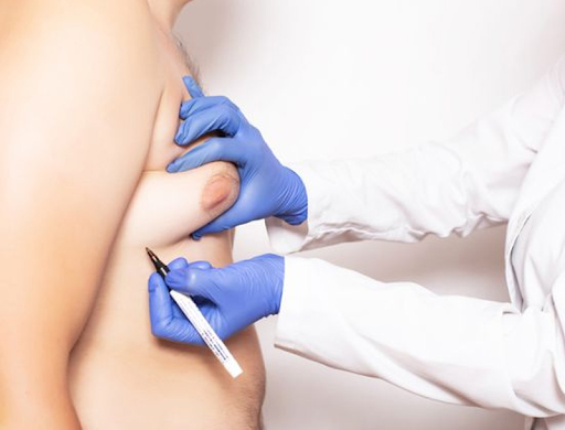 best gynecomastia surgeon in India