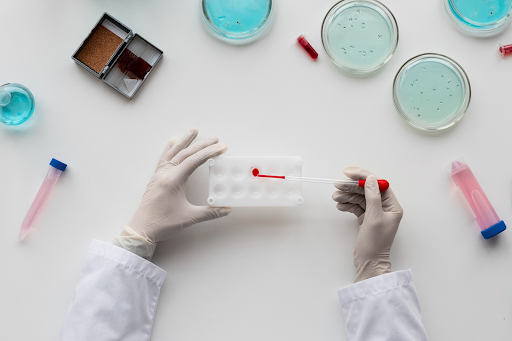 western blot method
